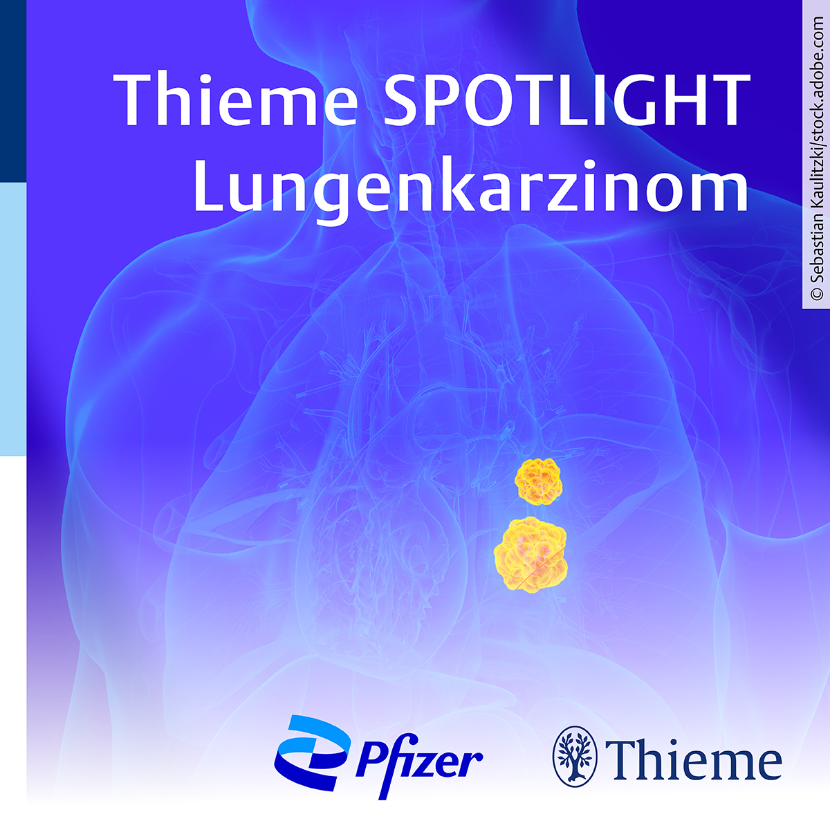 Spotlight_Lunge_Pfizer_1200x1200